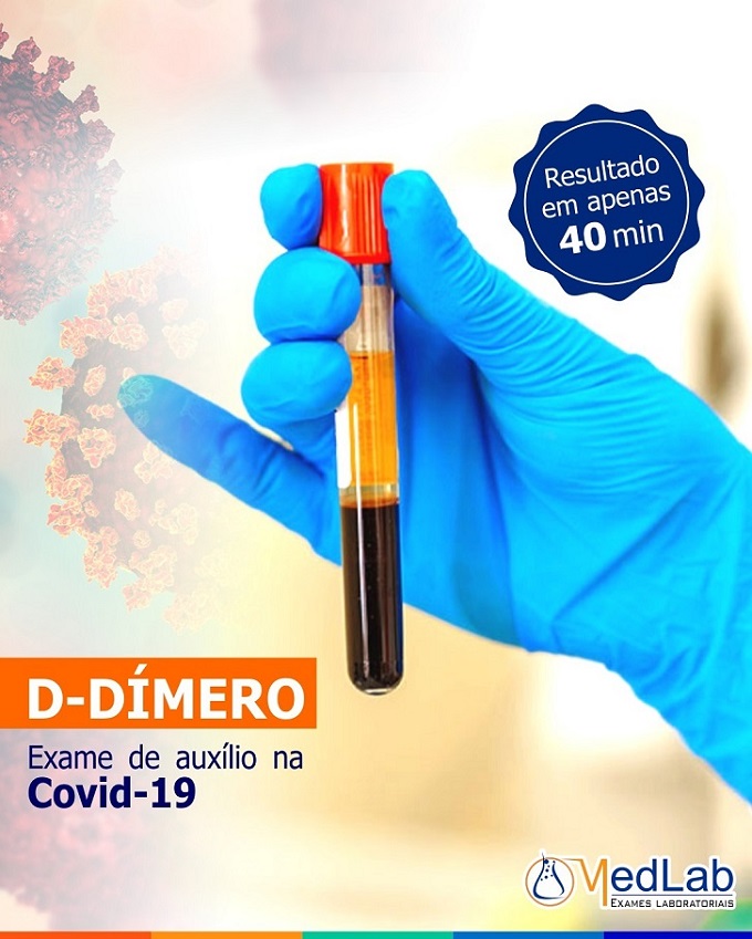 exame de D-Dímero em nova iguaçu